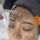 건대 피부관리 휘브로 세라링 스킨플래닝 후기
