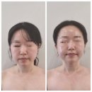 청주 가경동 피부관리 퀸스킨앤바디 | 얼굴윤곽관리 받은 후기