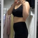 멍발란스 | 복부지방흡입 한달차 리얼 후기 통증 멍 완화시기 정보