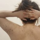 제주바디관리 모앤시에스테틱 등필링 후기, 팔 흉터 케어까지 만족했던 관리