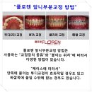 정이치과기공소 | 앞니부분교정 효과적으로!