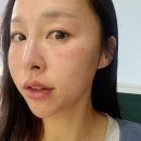 세포 | 서초동 피부과 줄기세포 슈퍼셀 후기