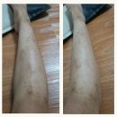 아나파적맥통증의원 이미지