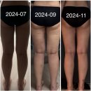 이음산부인과의원 | 이음산부인과 다이어트 리얼 후기 순도 200%