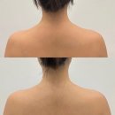 희망에너지 | 휴아라ㅣ송파 예신 관리 끝판왕 승모근 에너지 테라피 솔직 후기