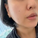 소현이네화장품 | 송도 피부관리 에스테티아 1회 만으로 만나는 신세계! (송도 윤곽관리 솔직 후기)