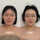 미야뷰티 | 대구 수성구 황금동 얼굴소멸 윤곽관리 또와뷰티 솔직후기