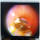 복음보청기 강동센터 이미지