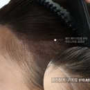 헤어라인 이미지