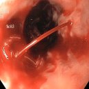 비어밸리 이미지