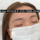 비로우
