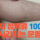 하지 정맥류 운동 100%효과 보는 운동법 이미지