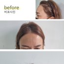 더모어 이미지