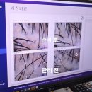 산본이마트 건너편 | 닥터모락 산본점에서 받은 산본탈모 관리 후기