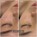 성산구 ⓒ-31 | 창원에스테틱 오유브이(OUV)에스테틱 여름맞이 수분앰플관리