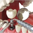 하양탑치과 이미지