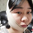 하이메디텍 | 1회 사용으로도 확연히 턱목살라인이 달라지는 아트메디텍 리프팅밴드 브이라인 얼굴밴드 구매후기