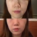 관섭2 | [대구/범어동] 핫탄스파 범어점 | 대구윤곽관리 V라인 리프팅 관리 후기 신부관리 추천