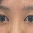 세명대구내안경 위드렌즈 이미지