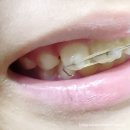 슈어치과교정과치과병원 네이버블로그