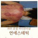테라타워1072 | 파주 운정 연에스테틱 바디관리 에너지 테라노바 등관리 후기