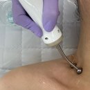계림메디칼 | 광주 계림동 스킨스케일링 찐 후기, 슬뷰티
