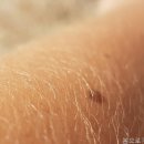 봄으로가는의원 네이버블로그