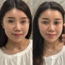 마산피부관리 에르모소에서 받은 예비신부 웨딩관리 후기