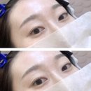 아나덴슈가링왁싱분당야탑역점