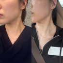 혜원에스테틱 | 일산 화정 피부관리 신혜원에스테틱 리볼업 윤곽관리 웨딩케어 후기