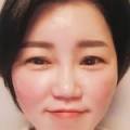 다이아 인셀덤