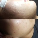 아리따운피부 이미지