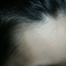 영헤어라인 이미지