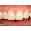 앞선치과기공소 이미지