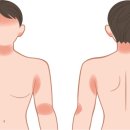 핀란드테라피