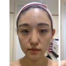 브이라인샵 이미지