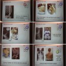 LIG손해보험 | lig손해보험 미니클래스 후기 - 척추측만증과 교정운동까지