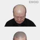 이노드 울산 이미지