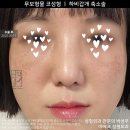 모자이크성형외과의원 이미지