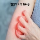 브이원약국 | 임산부 피부 트러블 크림 이브스 안전하게 안티에이징