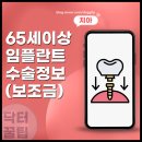 한도치과의원 | 65세이상 임플란트 금액 비용 본인 부담금 및 정부 보조금 지원금 몇개까지 가능?