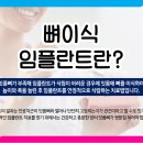 항동서울치과의원 네이버블로그