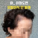 무경계 | 강남두피문신 73세 할머니에서 '언니'로, M자 헤어라인 무경계 공법 회춘 후기