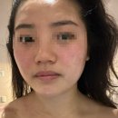 덕용프라자 | 작전동 피부관리/육곽관리는 탐날에스테틱