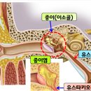 유스타키오관 이미지