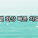 햇볕 화상 빠른 치료법