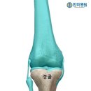 한미정형외과