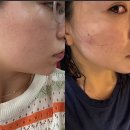 트리니티병원 | 부산서면피부과 트리니티 솔직 후기