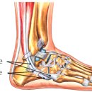 더공감마취통증의학과의원 | 잠실역 정형외과 더공감마취통증의학과 발목 통증 비골근 건염으로 진단 후 치료한 사례