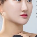 오름에스테틱
